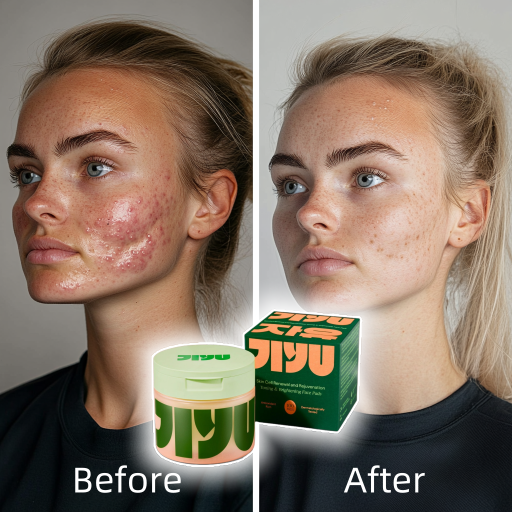 Lyron™ Korean Skincare Toner Pads