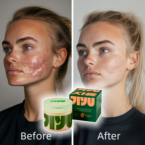 Lyron™ Korean Skincare Toner Pads